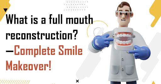 What is a full mouth reconstruction?—complete smile makeover!